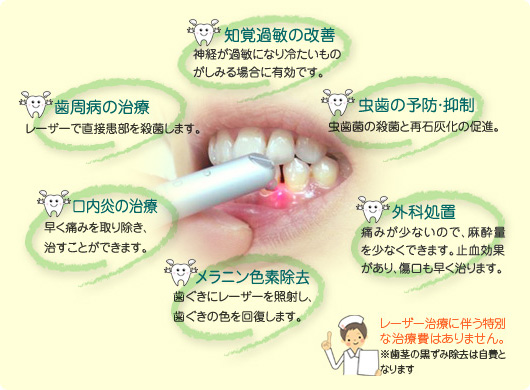 レーザー治療について